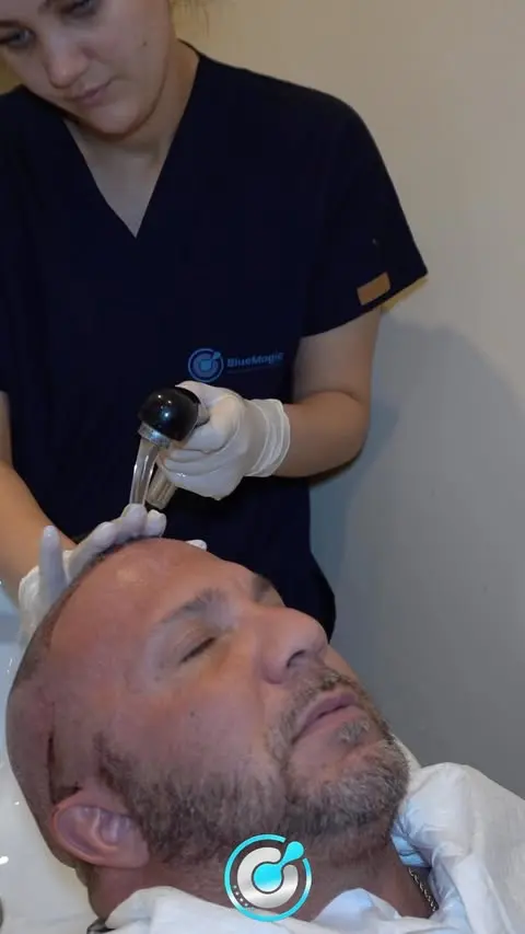 La più grande e migliore clinica di trapianto di capelli sta per arrivare in Albania. ✨