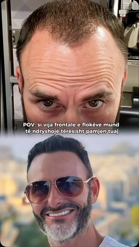 Gjithçka nis me vijën FRONTALE.