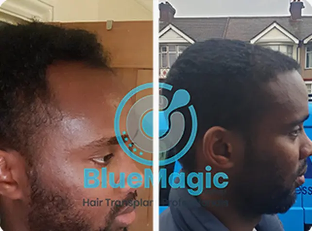 Before / After: Afro hair, full restoration