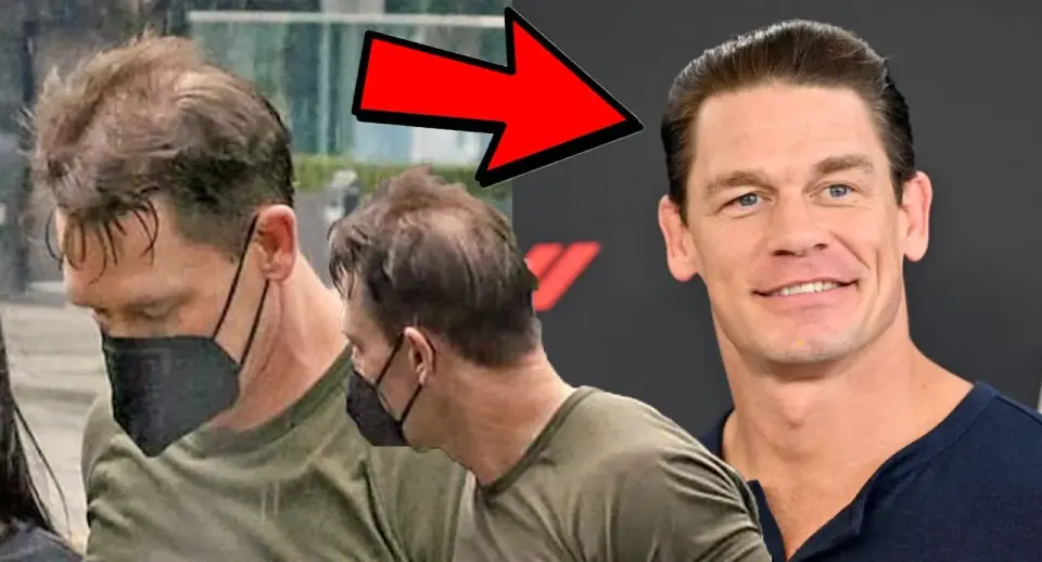Celebrity John Cena showcasing his improved hairline after undergoing an advanced hair transplant procedure.