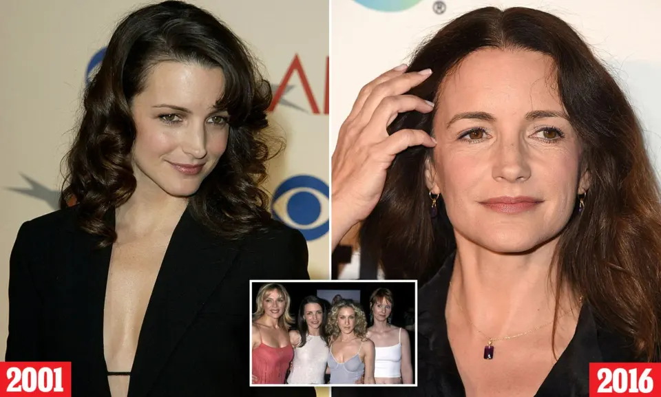 kristin davis hair transplant