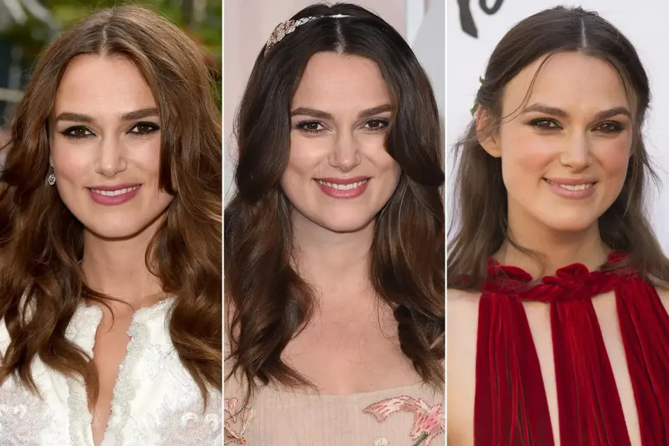 keira hair transplant