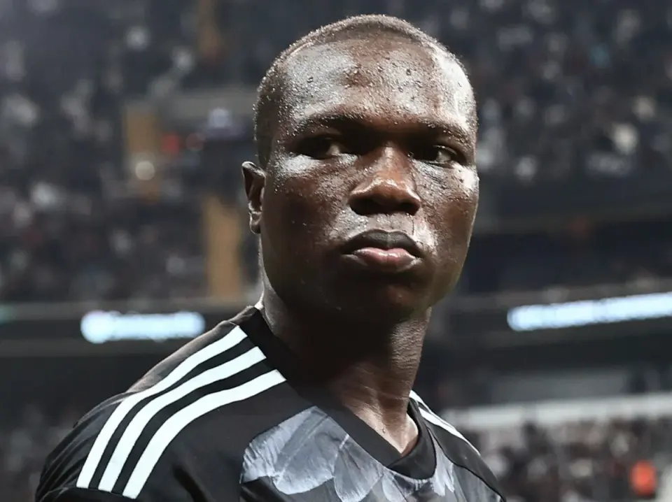 abubakar hair transplant