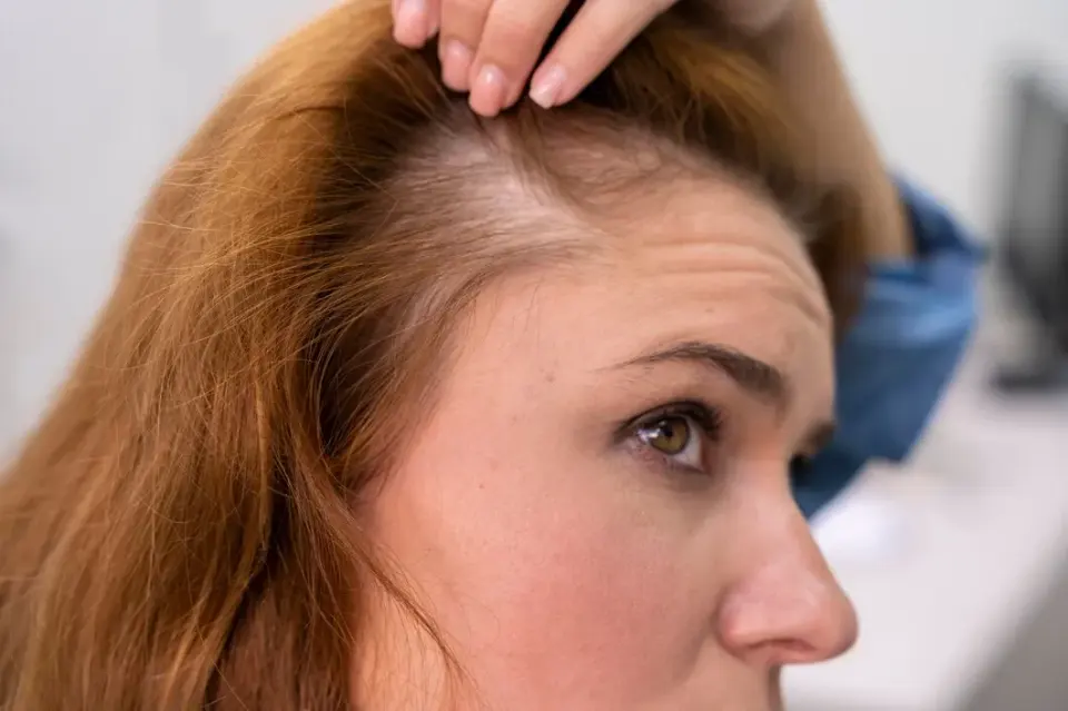 restore hairline