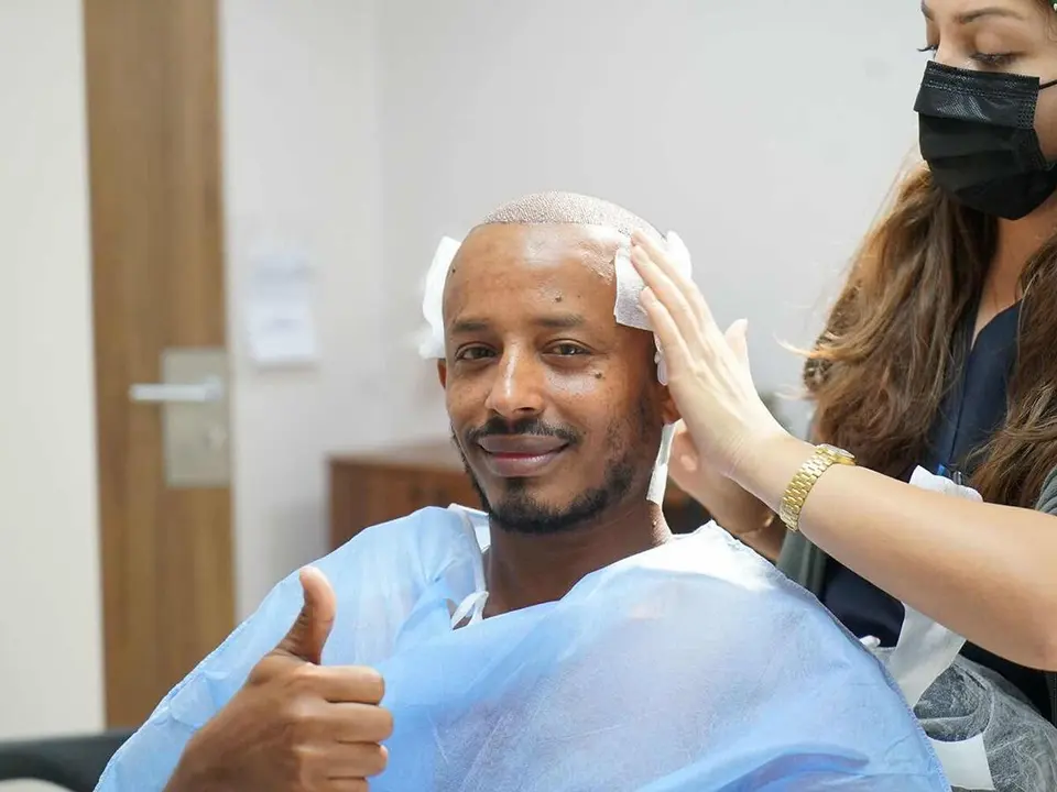 Afro Hair Transplant